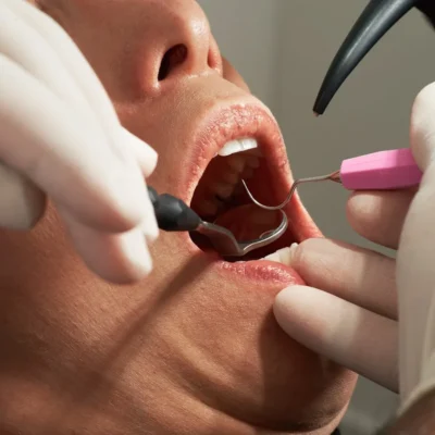 Jerusalem Dentist Collapses Mid-Treatment, Saved After Suffering Cardiac Arrest